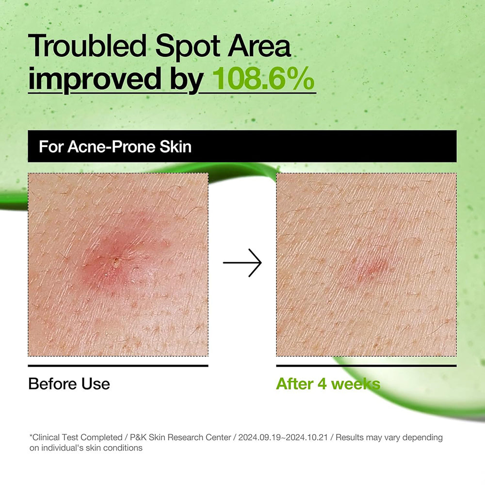 ANUA Azelaic Acid 10 Hyaluron Rötung Beruhigendes Serum - Beruhigung und Feuchtigkeit, 30 ml