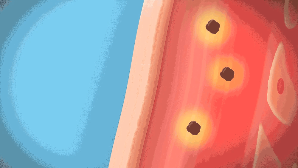 ACROPASS Dark Spot Care 6 Patches