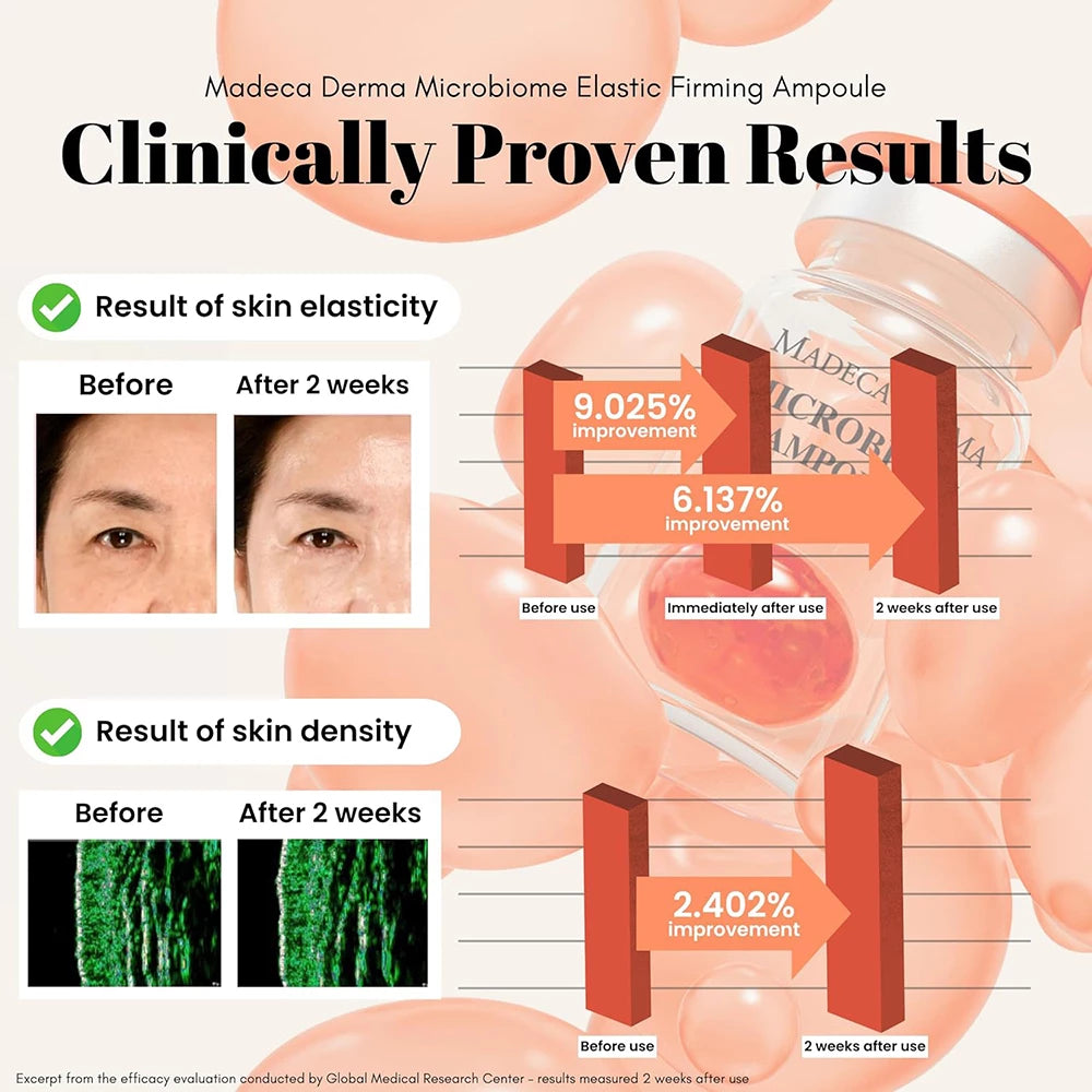 MADECA DERMA Elastic Firming Microbiome Ampoule - Gesichtsserum formuliert mit Niacinamid und Beta-Glucan, das zur Hautfeuchtigkeit und zum Hautkomfort beiträgt - 7 ml x 5 Stück