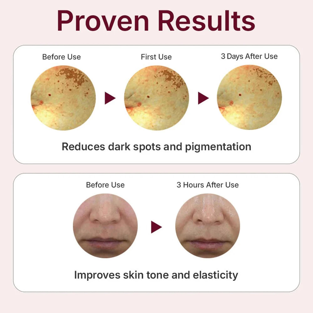 CENTELLIAN24 Expert Madeca Mela Capture Ampoule Max - Gesichtsserum mit MadeWhite Max und Niacinamid zur Korrektur von ungleichmäßigem Hautton und zur Reduzierung von Pigmentflecken - 3 x 15 ml
