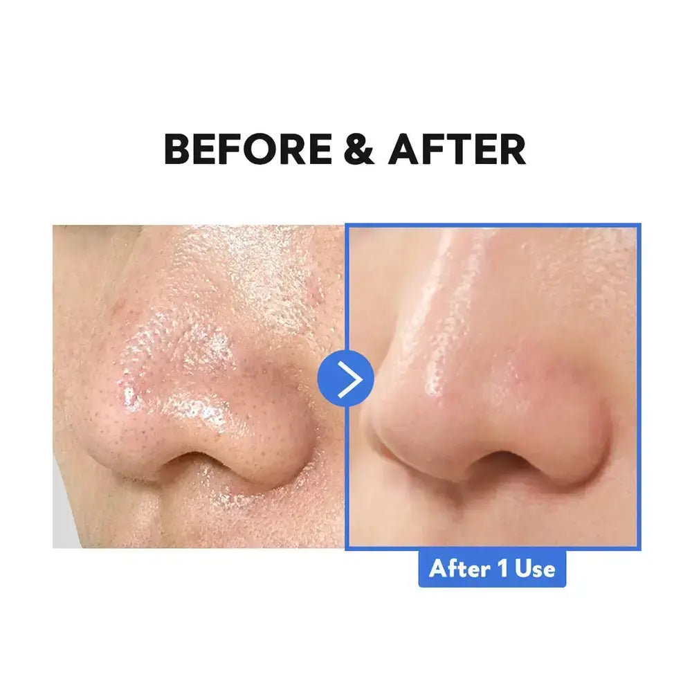 TIRTIR Hydro Boost Enzyme Cleansing Balm