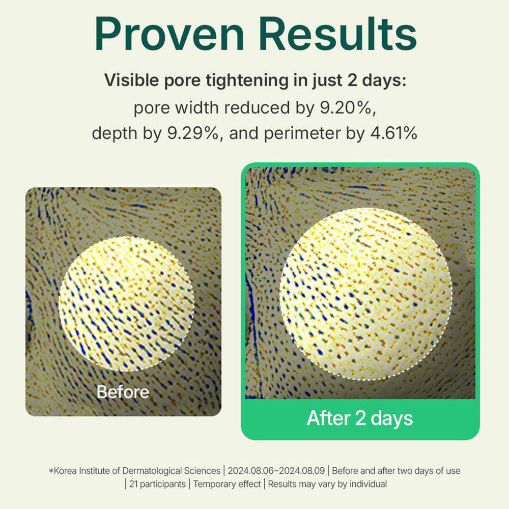 CENTELLIAN24 Madeca Powder TeaTree AC Puder für das Gesicht - Glättung und Vereinheitlichung, 6 g