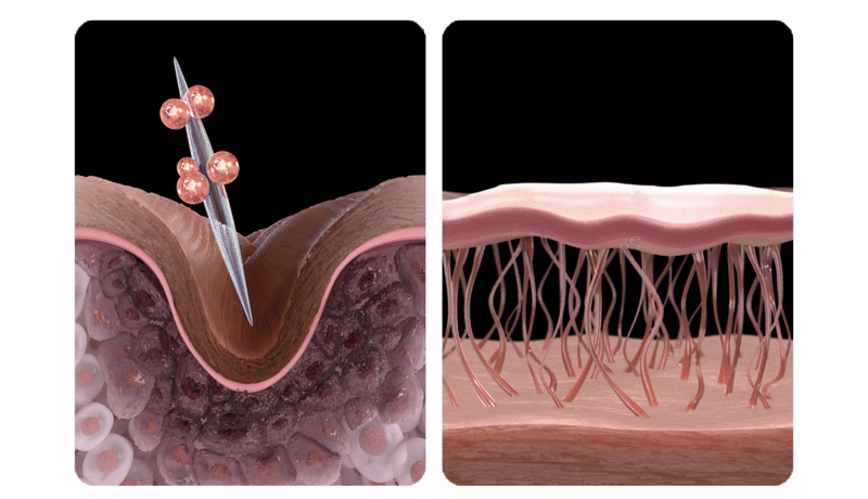 Dr. Melaxin Necklinephalt Halscreme - Gesichtscreme formuliert mit Bio-Spicula und Linefill, die zur Erscheinung von Halslinien beitragen und den Hautkomfort erhalten - 20 ml