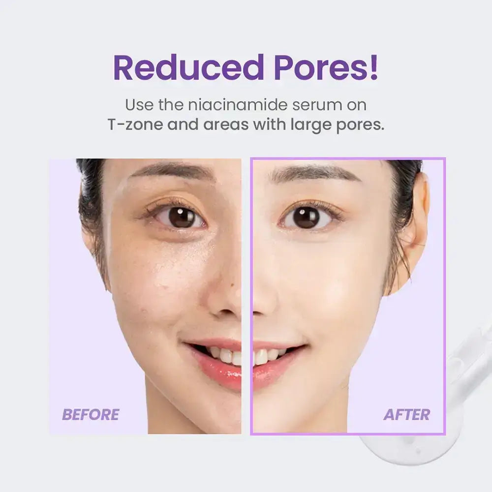 TIRTIR Niacinamide 20% - Gesichtsserum mit Niacinamid und Retinol zur Aufhellung, Hautbildverfeinerung und Regulierung der Talgproduktion - 30 ml