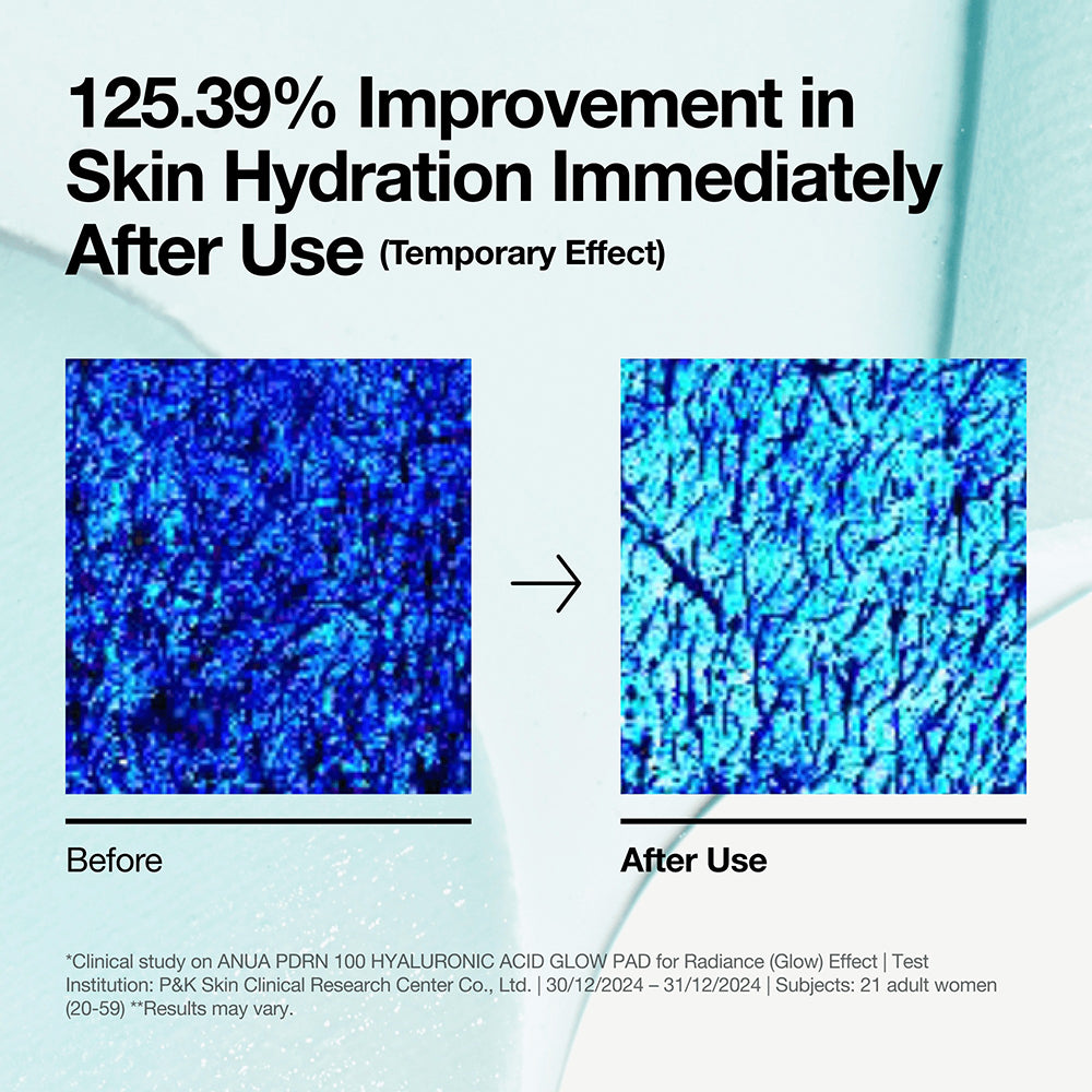 ANUA PDRN 100 Hyaluronsäure Glow Pad Toner - Feuchtigkeit und Leuchtkraft, 60 Stück