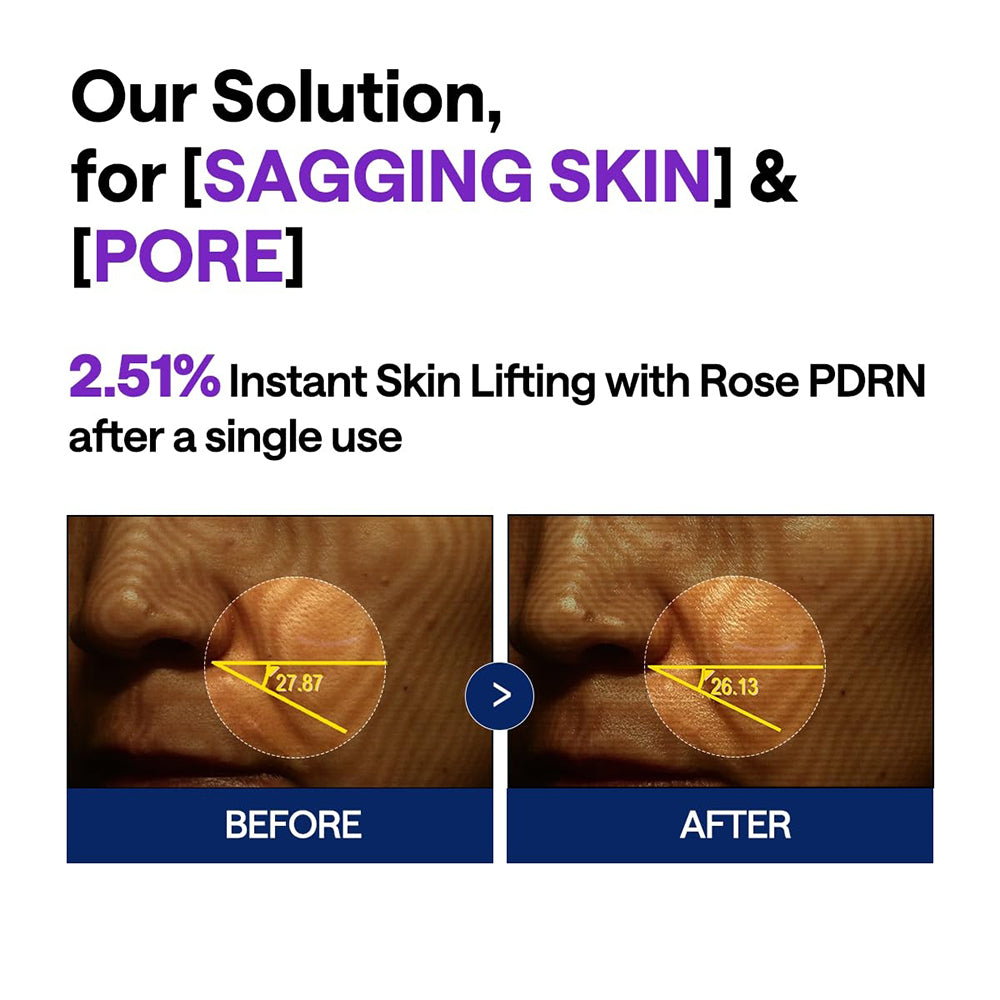 MEDIHEAL PDRN Lifting-Serum Gesichtsserum 40 ml