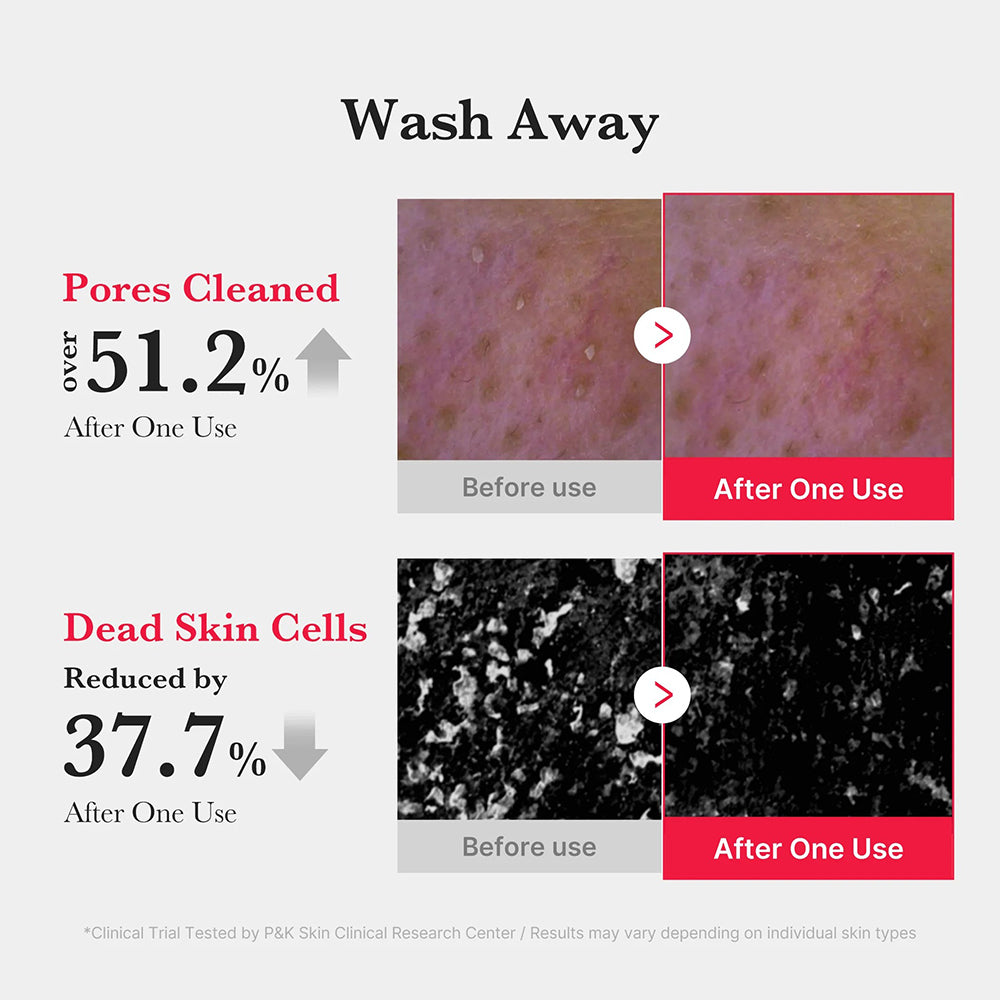 MEDICUBE Red Foam Cleanser - Reinigungsschaum mit Salicylsäure 0,5% und Sophora angustifolia Extrakt, zur Tiefenreinigung der Poren und zur Aufrechterhaltung des Hautgleichgewichts - 120 ml