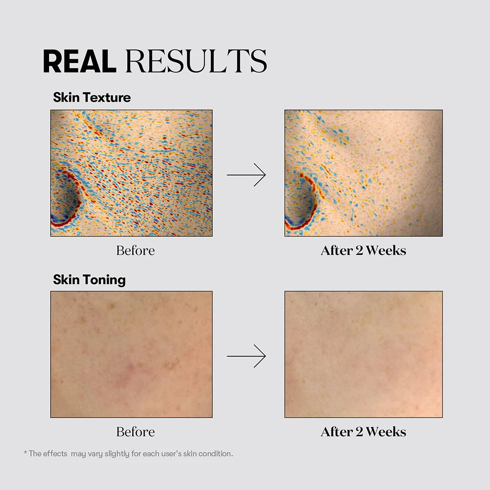 VT COSMETICS TX-Toning Tagesmaske - Maske mit Niacinamid und Tranexamsäure für einen ebenmäßigen und strahlenden Teint - 30 Stück