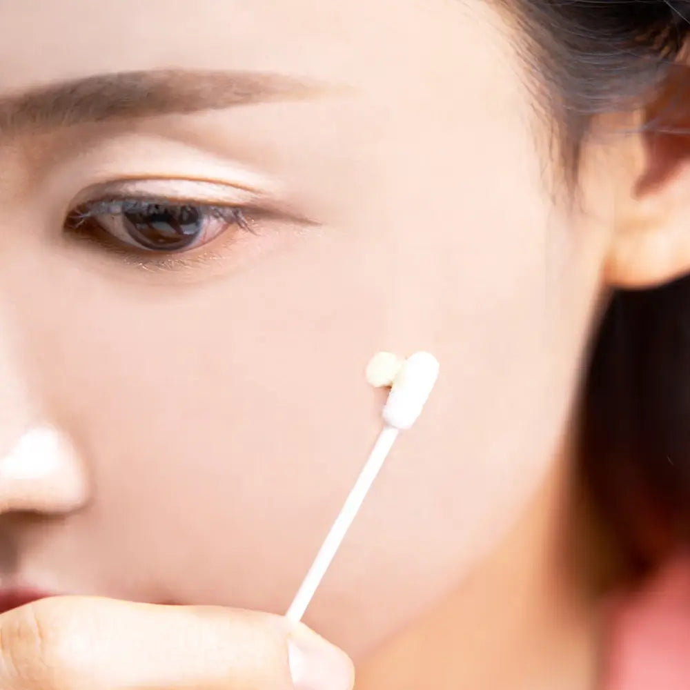 KOCOSTAR Gelbcreme-Patch – Creme formuliert mit Niacinamid und Teebaumblatt-Extrakt, die zur Verbesserung des Hautbildes bei Flecken und Akne beitragen – 20 ml