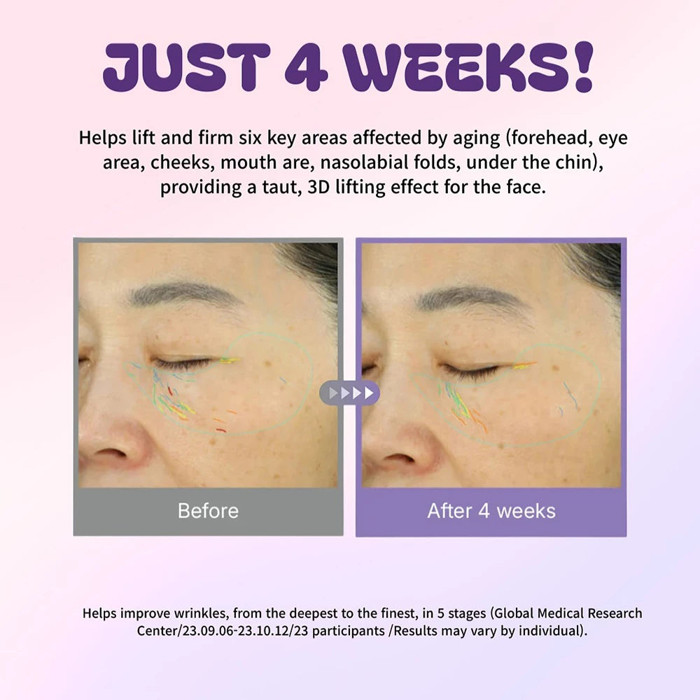 CENTELLIAN24 360 Shot PDRN Active Serum - Gesichtsserum mit Hyaluronsäure und Kollagen für Hautfeuchtigkeit und Komfort - 50 ml