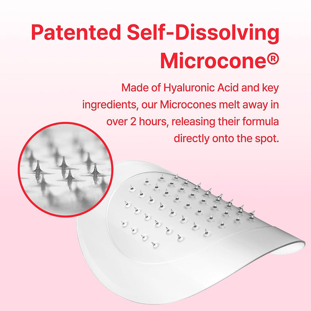 ACROPASS Jolly Filly Lippen-Plumping-Patch - Lippenmaske mit Hyaluronsäure und Capsicum Frutescens Fruchtextrakt zur Feuchtigkeitsversorgung der Lippen und zur Verbesserung des Lippenvolumens - 2 Stück