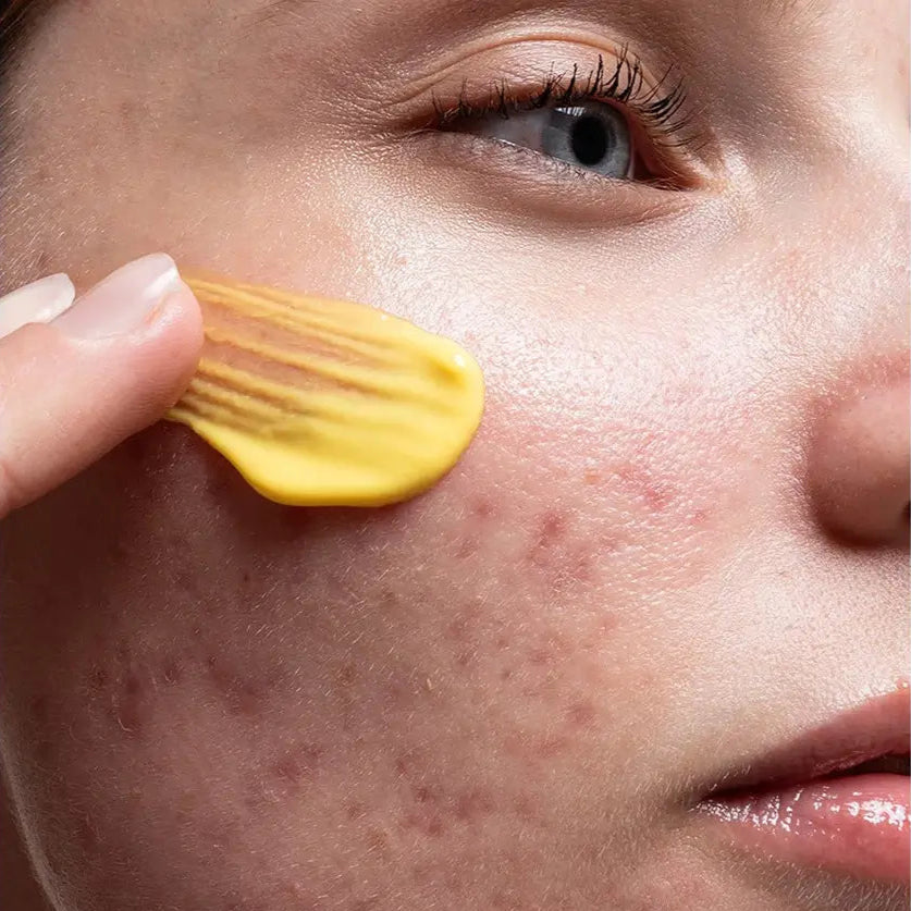 Inhaltsstoffe: Encapsulated Retinal, Peptide‑Komplex, Ornithin‑EGCG, Ceramide & Omega Komplex
