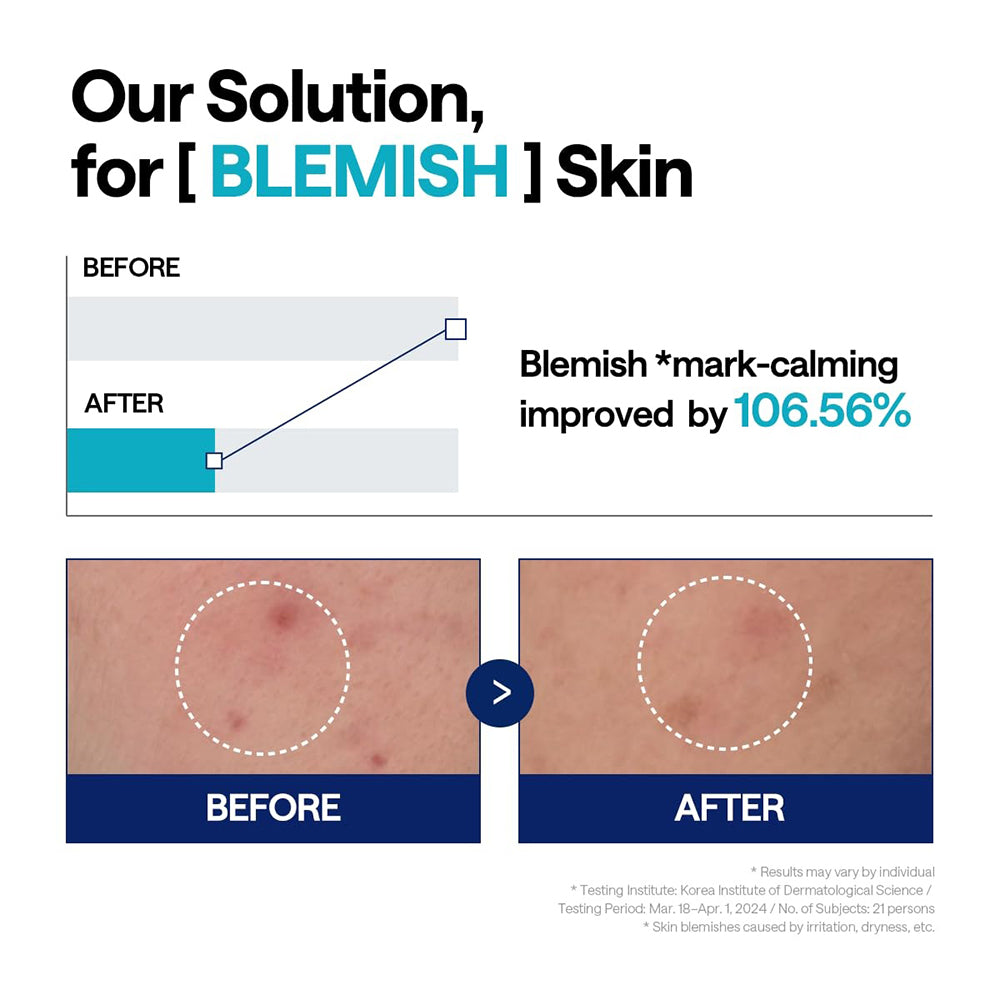 MEDIHEAL Madecassoside Blemish Repair Serum - ser de fata formulat cu madecassoside si niacinamida, care contribuie la calmarea pielii si la uniformizarea aspectului tenului - 40 ml