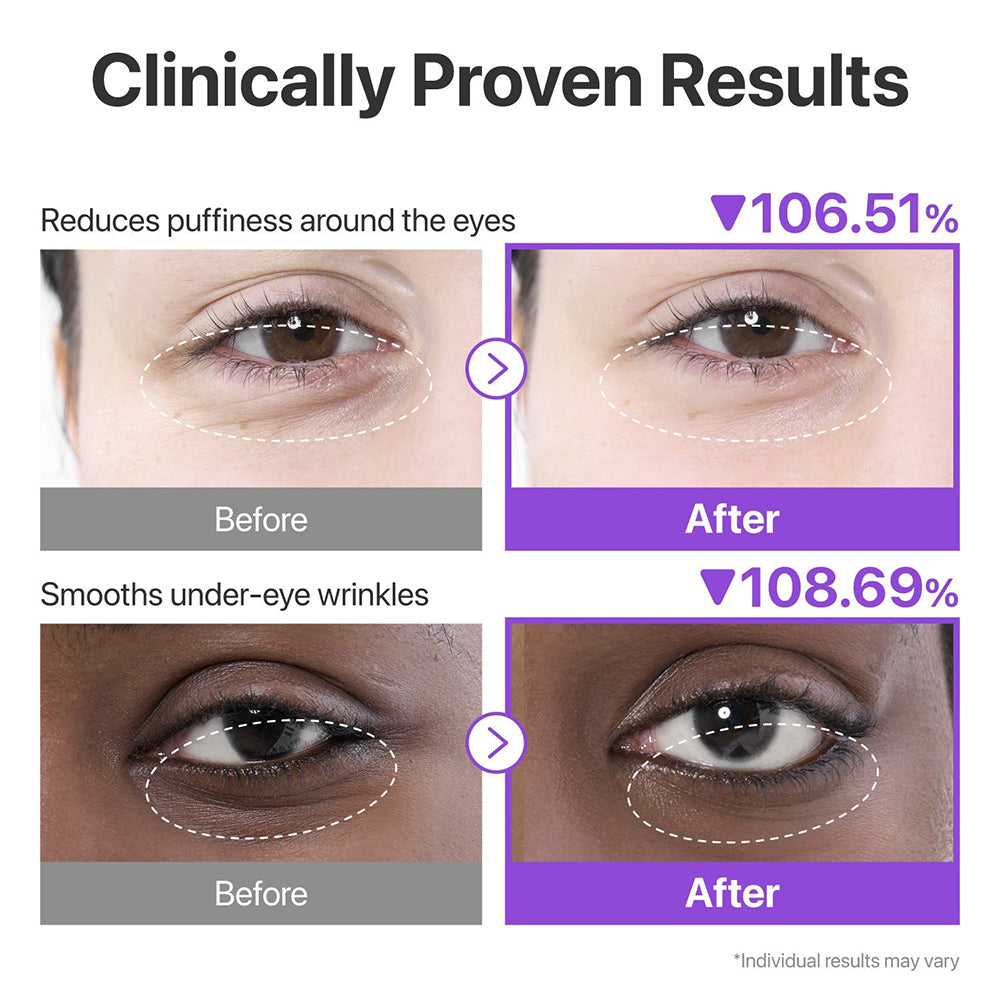 NUMBUZIN No.9 NAD+Collagen Under Eye Patches - benzi pentru ochi formulate cu colagen marin si niacinamida, care contribuie la diminuarea aspectului cearcanelor si la mentinerea prospetimii zonei perioculare - 5 buc