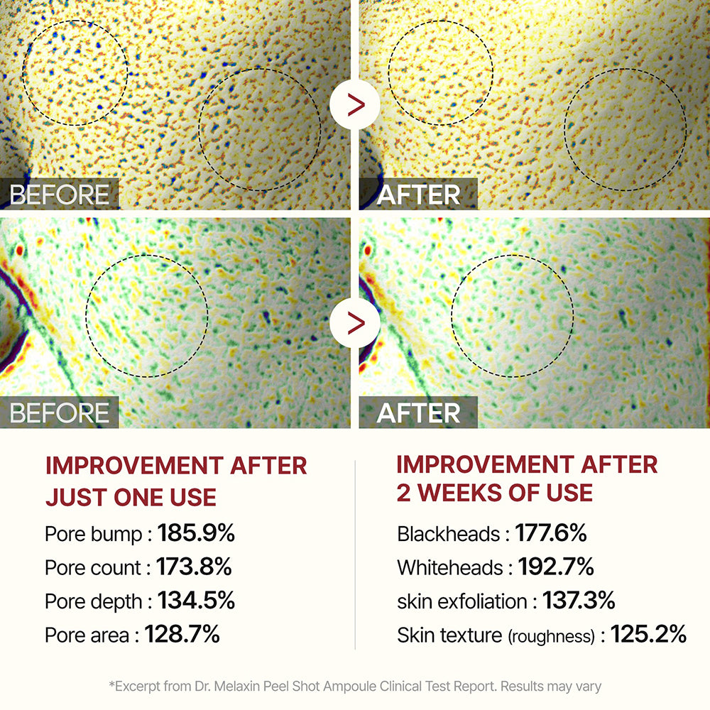 Dr. Melaxin Peel Shot Peeling Black Rice Ampoule