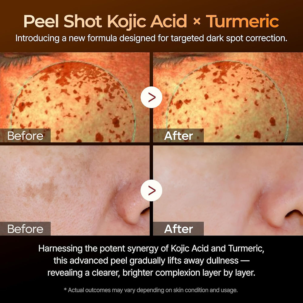 Dr. Melaxin Peel Shot Exfoliating Kojic Acid Turmeric Serum