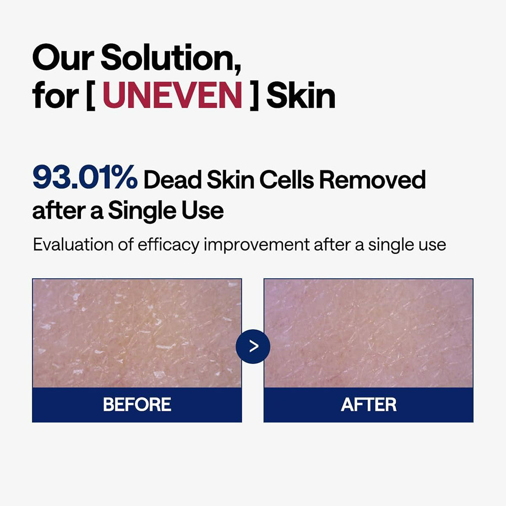MEDIHEAL Phyto-enzyme Peeling Pad - dischete exfoliante formulate cu LHA si papaina, care contribuie la indepartarea delicata a celulelor moarte si la netezirea texturii pielii - 90 buc