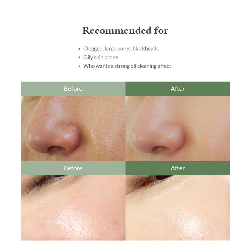 Dr. Althea Premium Quick Step Sebum Cleanser - Gesichtswasser mit Mungobohnen- und Weidenrindenextrakt zur Entfernung von überschüssigem Talg und Verhornungen