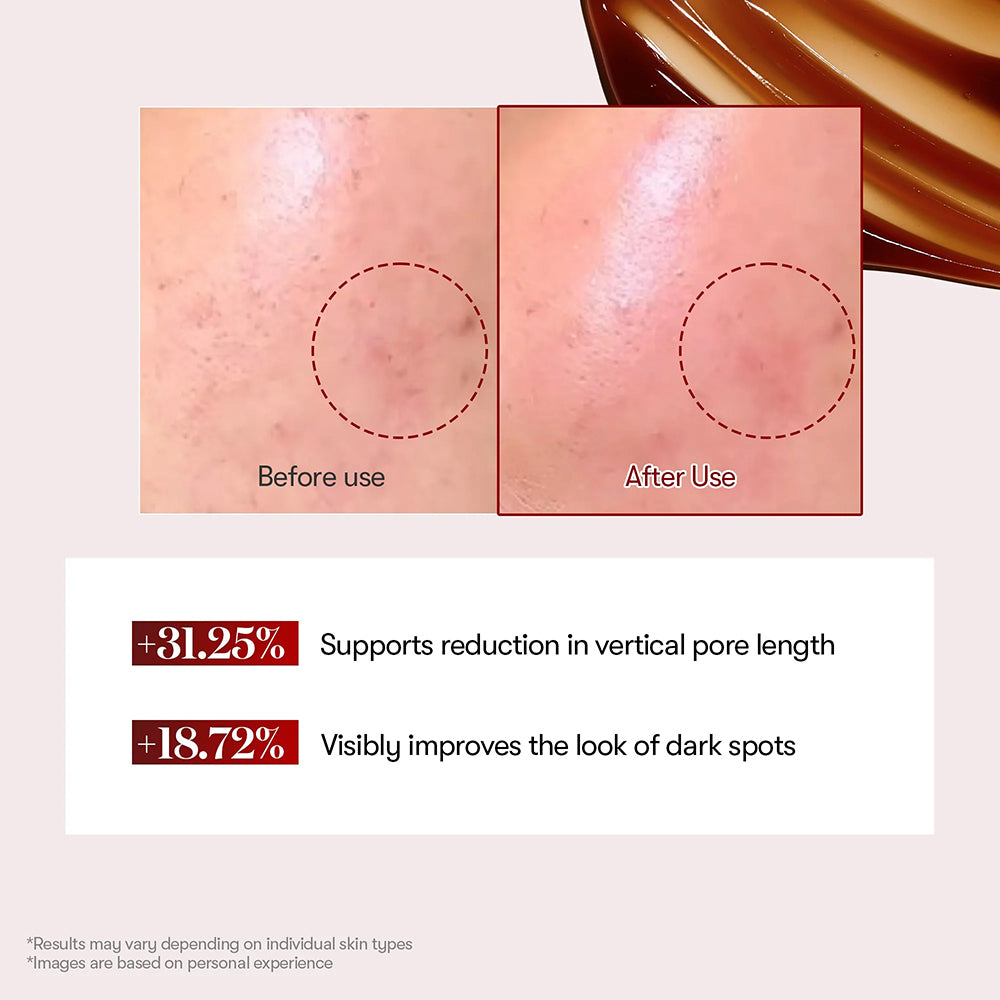 VT COSMETICS Red Booster Reedle Shot 100 - Gesichtsserum mit Niacinamid und Arbutin zur Aufhellung des Hauttons und Minderung von Pigmentflecken - 50 ml