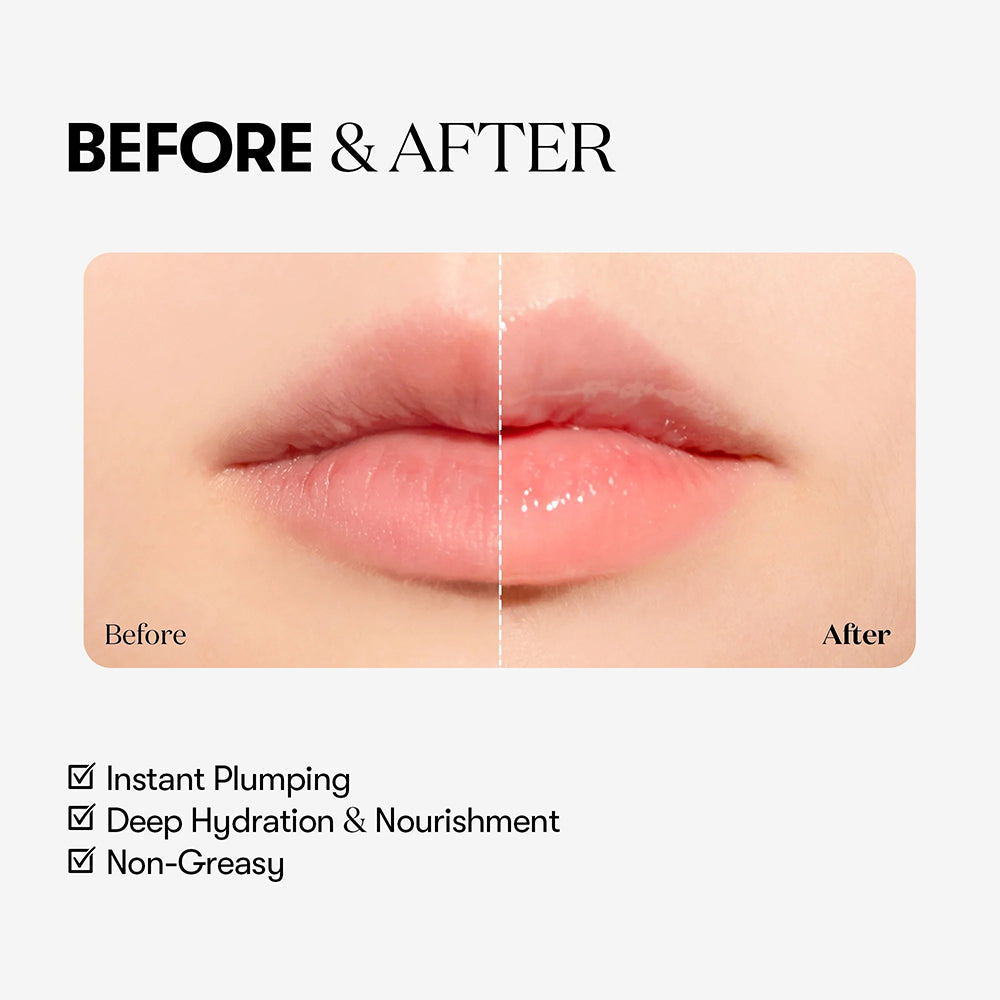 VT COSMETICS Reedle Shot Lip Plumper Beginner - Lippenbalsam mit Centella Asiatica und Hyaluronsäure zur Lippenhydratisierung und Pflege - 4,3 g