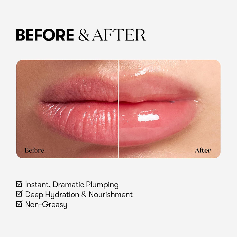VT COSMETICS Reedle Shot Lip Plumper Expert - Lippen aufpolstern mit Centella Asiatica und Hyaluronsäure für vollere Lippen - 4,3 g