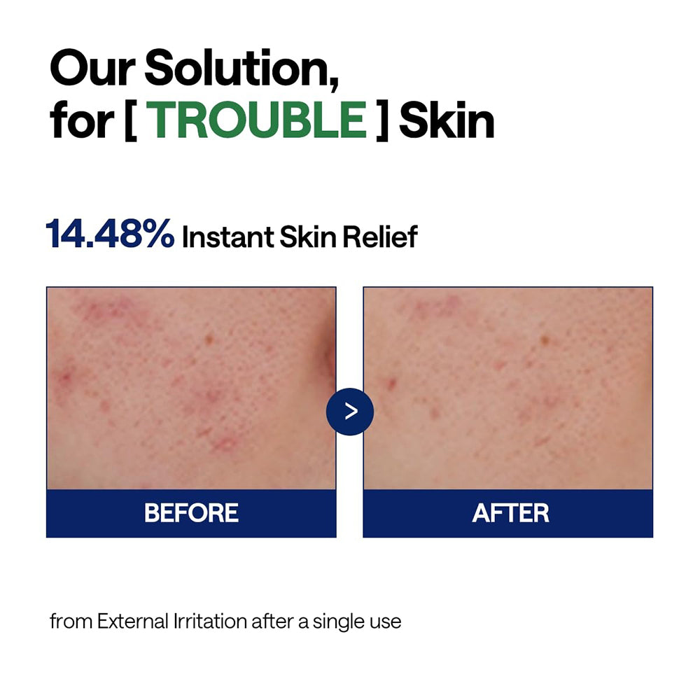 MEDIHEAL Teebaum Beruhigendes Hydra-Serum Gesichtsserum 40 ml