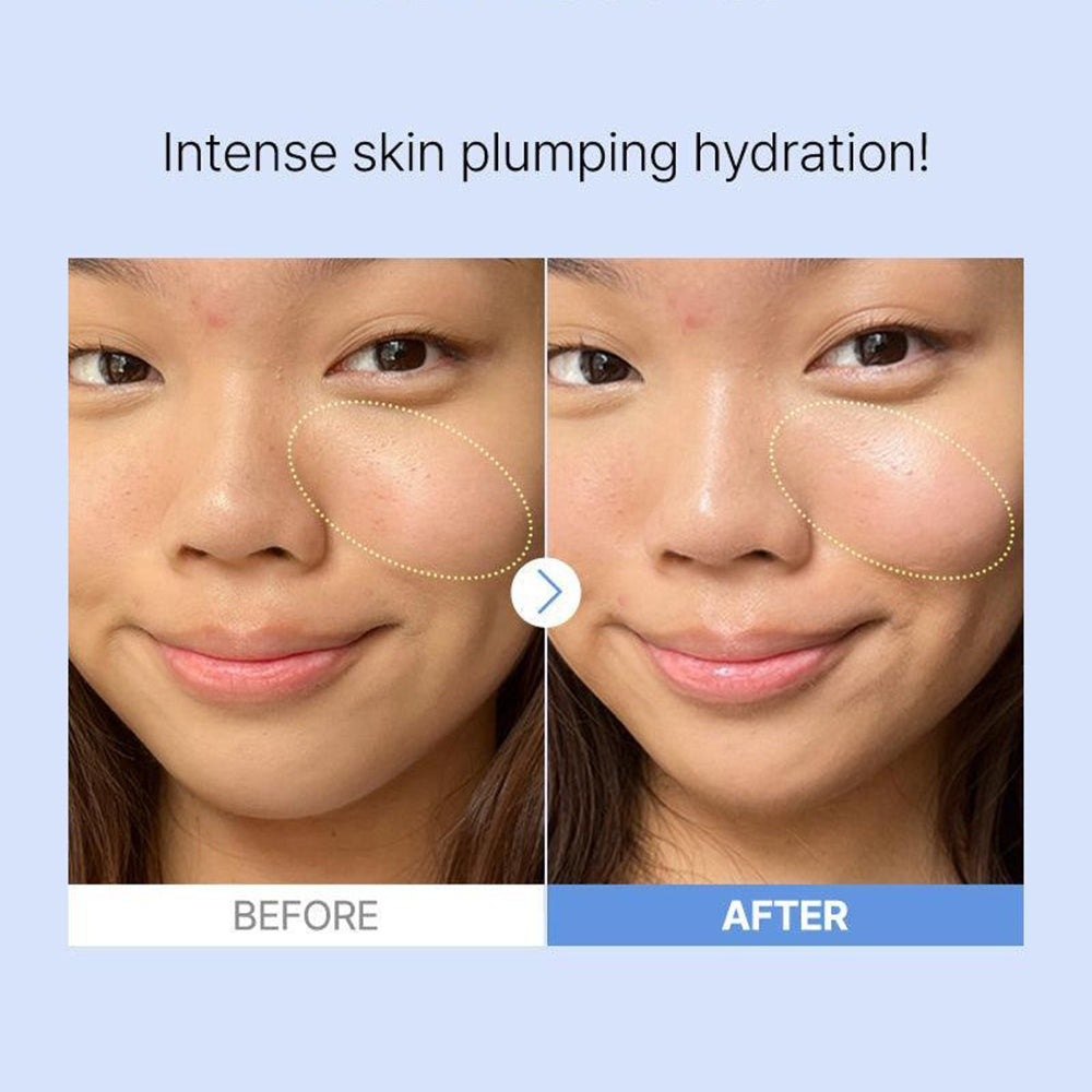 The Hyaluronic Acid 3 Serum Ser de fata 20 ml