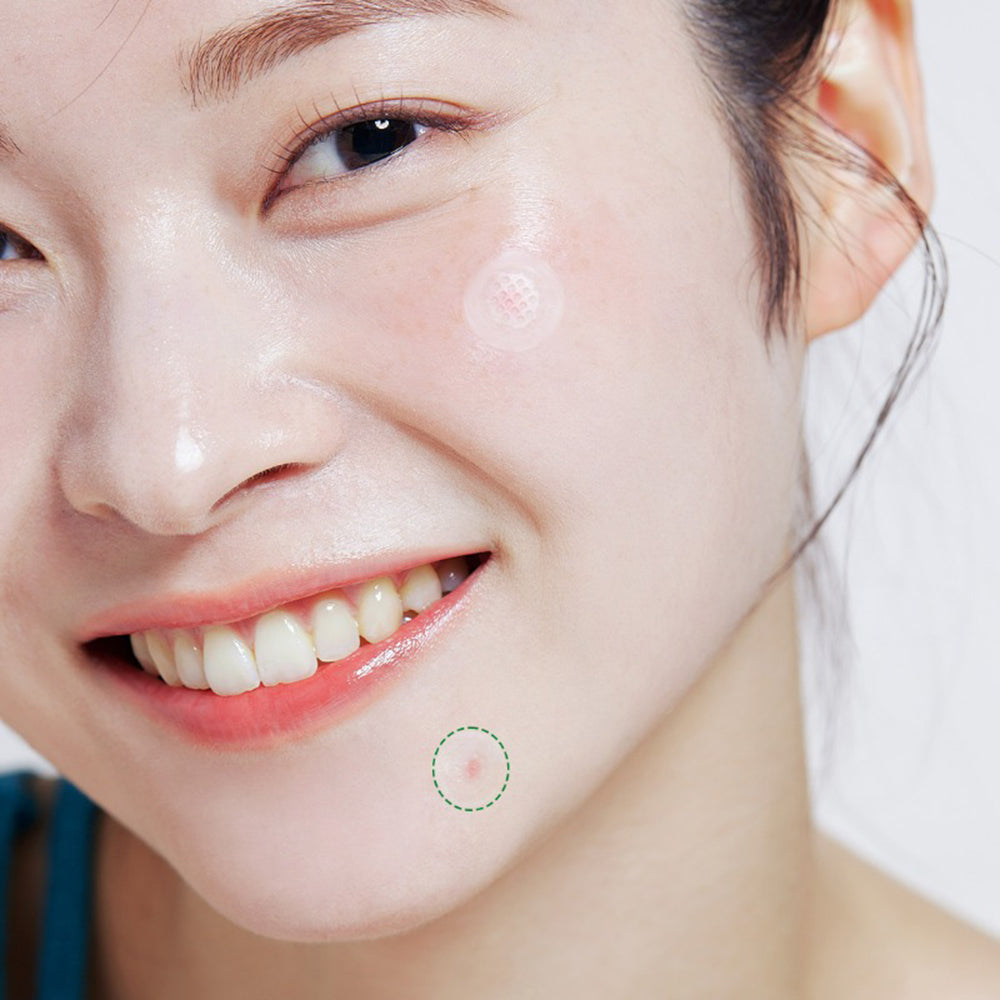 ACROPASS Trouble Care Microcone Patch Small - plasturi formulati cu niacinamide si Centella Asiatica (CICA), care contribuie la ingrijirea localizata a imperfectiunilor si la echilibrarea sebumului - 9 buc
