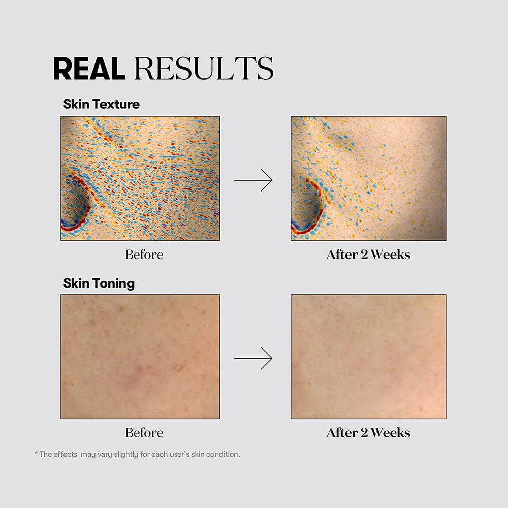 VT COSMETICS TX-Toning Creme - Gesichtscreme mit Tranexamsäure und Niacinamid zur Reduzierung von post-akneischen Flecken und Hyperpigmentierung für einen strahlenden Teint - 50 ml