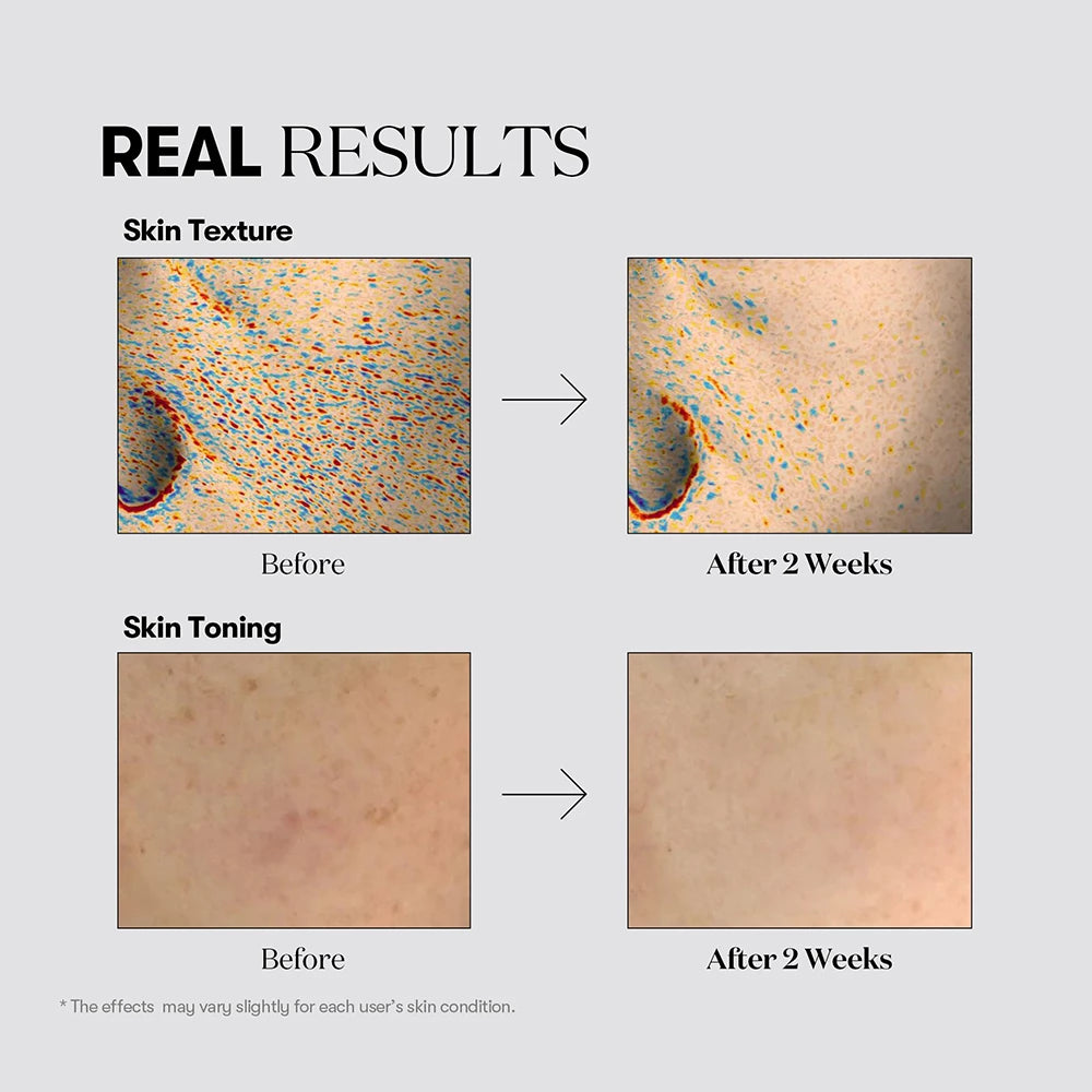 VT COSMETICS TX-Toning Essenz 1000 Shot - Essenz formuliert mit Tranexamsäure und Niacinamid, die zur Reduzierung von Pigmentflecken und zur Vereinheitlichung des Hauttons beitragen - 30 ml