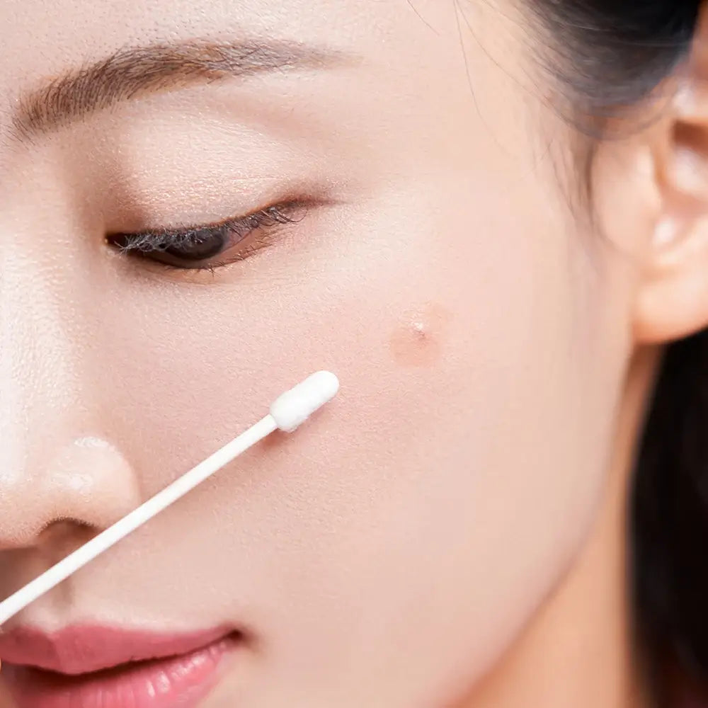 KOCOSTAR Gelbcreme-Patch – Creme formuliert mit Niacinamid und Teebaumblatt-Extrakt, die zur Verbesserung des Hautbildes bei Flecken und Akne beitragen – 20 ml